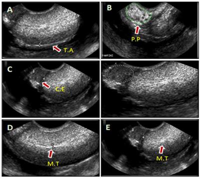 Characteristics of Ultrasound and Magnetic Resonance Imaging of Normal Testes and Epididymis Besides Angiography of Testicular Artery in Dromedary Camel